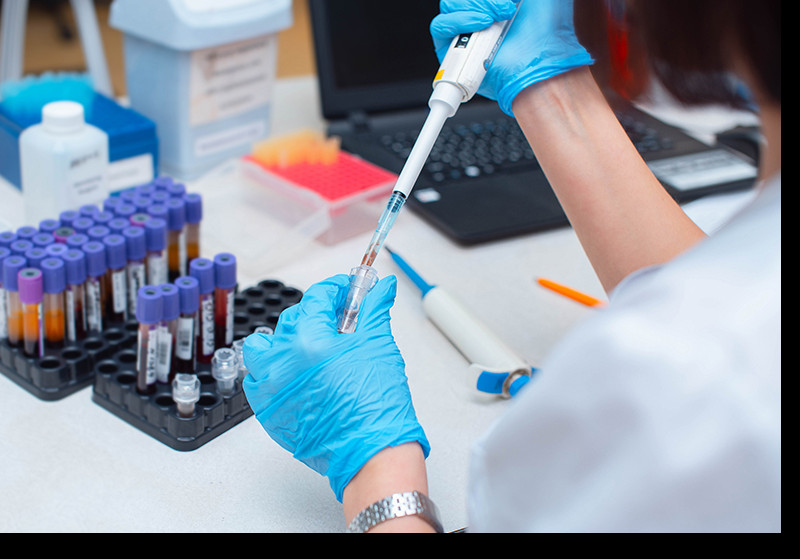 <h3>Prenatalni test - Sve što treba da znate</h3>