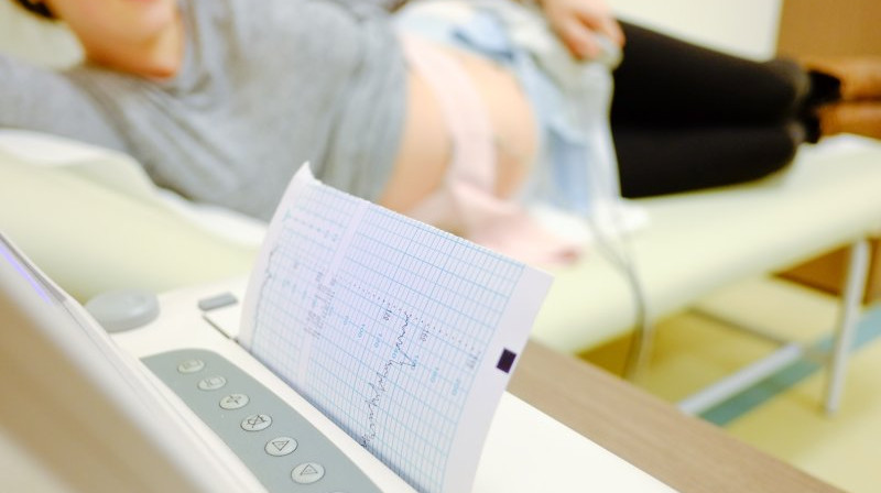 Šta je CTG pregled i kada se radi tokom trudnoće?