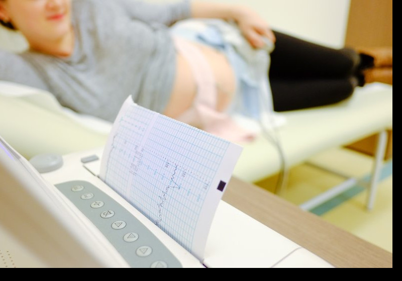 <h3>Šta je CTG pregled i kada se radi tokom trudnoće?</h3>